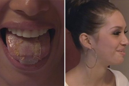 Maya Nava Tongue Surgery To Lose Weight from Starling Fitness